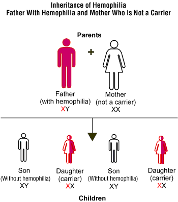 karyotype of hemophilia. hemophilia